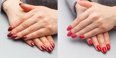manos de una mujer antes y después de la manicura y el tratamiento de la piel foto