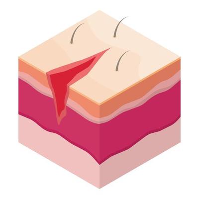 Open surgical suture icon, isometric style