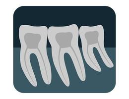 X-ray of human teeth. Three healthy molars on an x-ray. Vector illustration.
