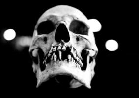 cráneo humano de fibra de vidrio que faltan dientes en un fondo negro foto