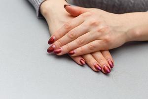 mano femenina con manicura de goma laca de nuevo crecimiento en dos meses después de la aplicación, necesidad de corrección foto