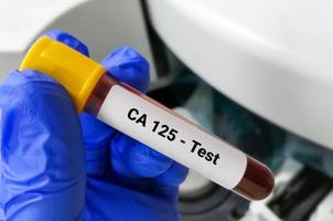 Blood Sample for CA-125 with laboratory background. Tumor Marker for ovarian cancer. photo