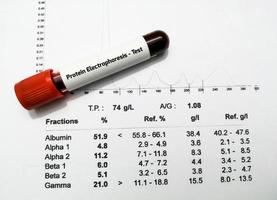 Blood sample and patient's report isolated for Protein Electrophoresis test. Close up. photo