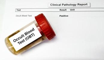 Stool sample container for occult blood test or OBT with abnormal patient's report. photo