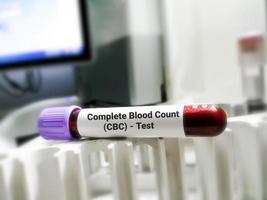 muestra de sangre para cbc o prueba de conteo sanguíneo completo. análisis hematológico. foto