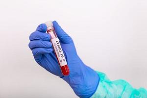 coronavirus covid 19 muestra de sangre infectada en un tubo de muestra en la mano del médico científico ropa de protección contra riesgos biológicos en el laboratorio de investigación coronavirus covid 19, investigación de la vacuna coronavirus covid-19 foto