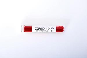 Positive COVID-19 test and laboratory sample of blood testing for diagnosis new Corona virus infection novel corona virus disease 2019 with hospital background. Pandemic infectious concept photo