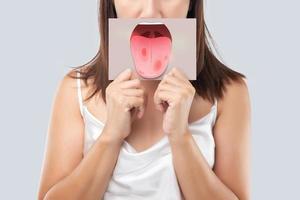 The woman show the picture of tongue problems photo