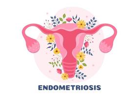 endometriosis con condición el endometrio crece fuera de la pared uterina en mujeres para tratamiento en ilustración de plantillas dibujadas a mano de dibujos animados planos vector