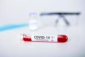 Positive COVID-19 test and laboratory sample of blood testing for diagnosis new Corona virus infection novel corona virus disease 2019 with hospital background. Pandemic infectious concept photo