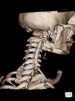 CT Scan cervical spine 3 D render . photo