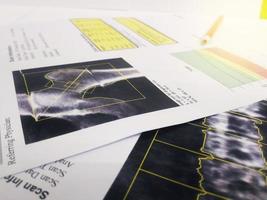 Close up bone density hip and lumbar spine report. photo