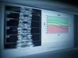 densidad ósea columna lumbar resultado osteoporosis foto