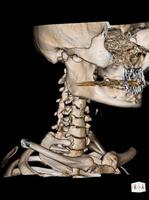 CT Scan cervical spine 3 D render . photo