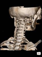 CT Scan cervical spine 3 D render . photo