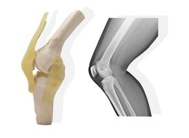 modelo y radiografía de la articulación de la rodilla foto