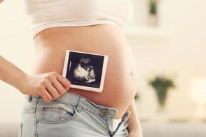 Cerca de la mujer embarazada con ecografía en su barriga foto