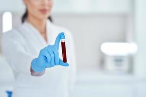 Woman holding test tube with blood and mixing machine photo