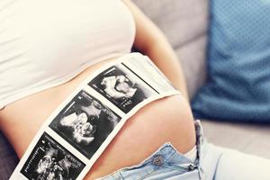 Close up of pregnant woman holding ultrasound scan on her tummy photo