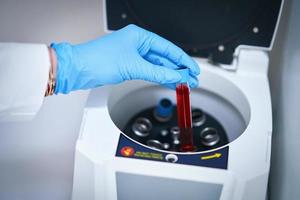 Test tube with blood and mixing machine photo