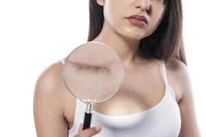 woman  showing surgery scar. Scars removal concept, close up, selective focus photo