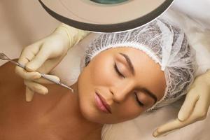 mujer durante un procedimiento mecánico de limpieza facial foto
