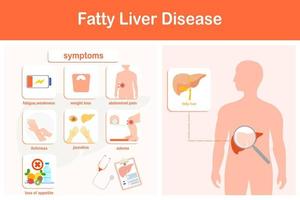Vector illustration. Infographic of fatty liver disease.  Weakness, jaundice, edema, pain in the right side of the abdomen, decreased appetite, and rapid weight loss.