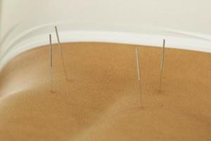 Female back with steel needles during procedure of acupuncture therapy photo