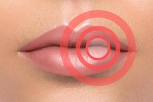Lips with red circles. Affected or problem area. Healthcare or beauty concept. photo