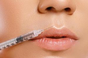 Female lips and syringe with a filler photo