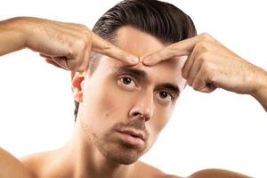 Young man is squeezing pimple on his forehead photo