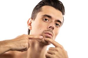 Young man is squeezing pimple on his chin photo