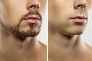 Male face Before and after shaving comparison. photo