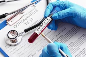 Scientist hand with a blood sample of SARS-CoV-2 photo