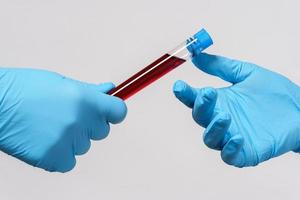 Scientist is giving a blood sample to a colleague photo