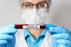 Female doctor is holding a blood sample of the COVID-19 photo