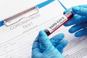 Scientist hand with a blood sample of SARS-CoV-2 photo