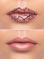 Chapped female lips after treatment photo