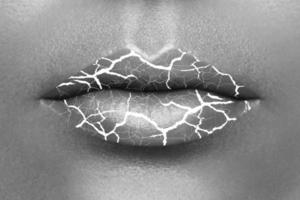 Closeup of chapped lips with a cracks photo