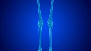 Kniegelenkschmerzen mit blauem Hologramm, die durch Knorpelverschleiß verursacht werden video