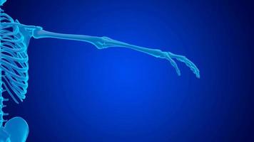 blauw hologram pols gewricht pijn veroorzaakt door langdurig inspanning Aan computer, laptop. carpaal tunnel syndroom video