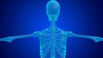 blue hologram human cervical spine pain caused by compression of the vertebrae video