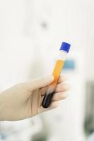 Vacutainer with a platelet-rich plasma and blood for PRP treatment photo