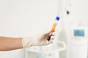 Vacutainer with a platelet-rich plasma and blood for PRP treatment photo