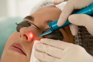 mujer durante la eliminación de lunares con láser en una clínica de estética médica foto