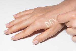 Female hands with itchy skin and DRY lettering on it photo