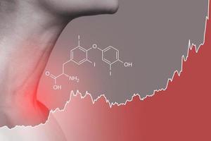 cuello femenino y gráfico de aumento de la hormona triyodotironina foto