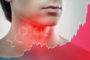 Male neck and chart of rising triiodothyronine hormone photo