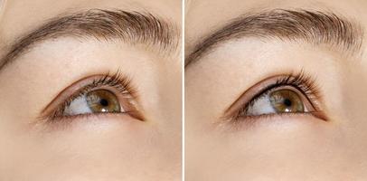 Comparison after professional permanent makeup treatment - lash line enhancement photo