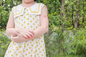 Little girl has skin rash allergy itching and scratching on her arm photo